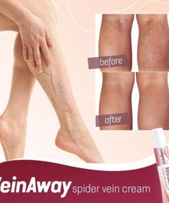 VeinAway Spider Vein Cream