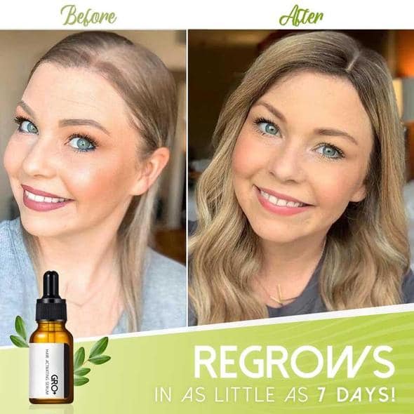 Gro+ hiuksia aktivoiva seerumi - Image 3