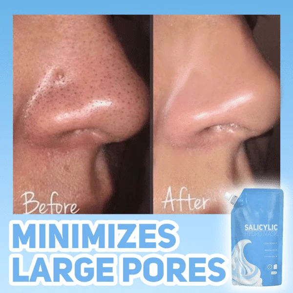 Salisyylihydro naamio - Image 3