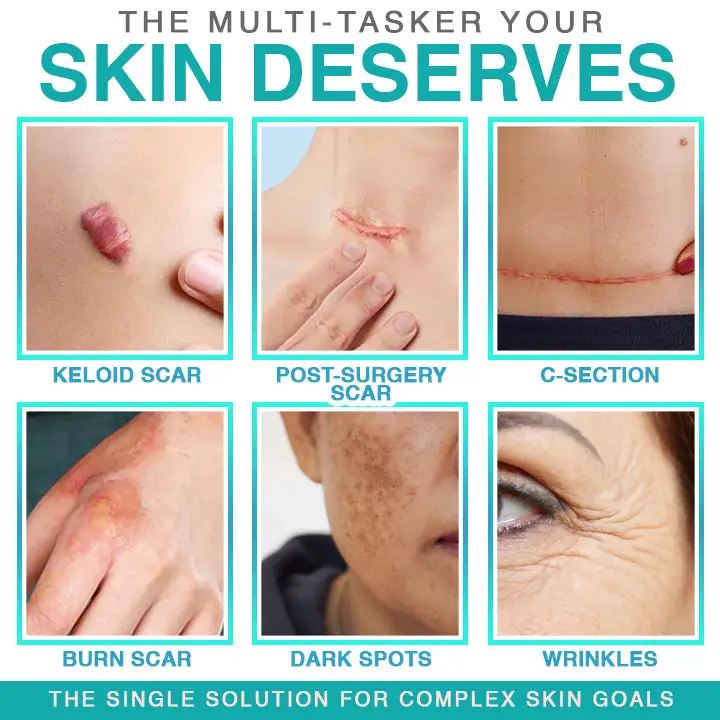 𝗖𝗮𝗿𝗲𝗕𝗿𝗲𝗲𝘇𝗲® 3-in-1 Microneedle Care Patch - Image 2