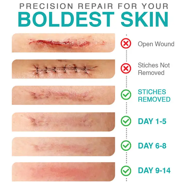 𝗖𝗮𝗿𝗲𝗕𝗿𝗲𝗲𝘇𝗲® 3-in-1 Microneedle Care Patch - Image 4