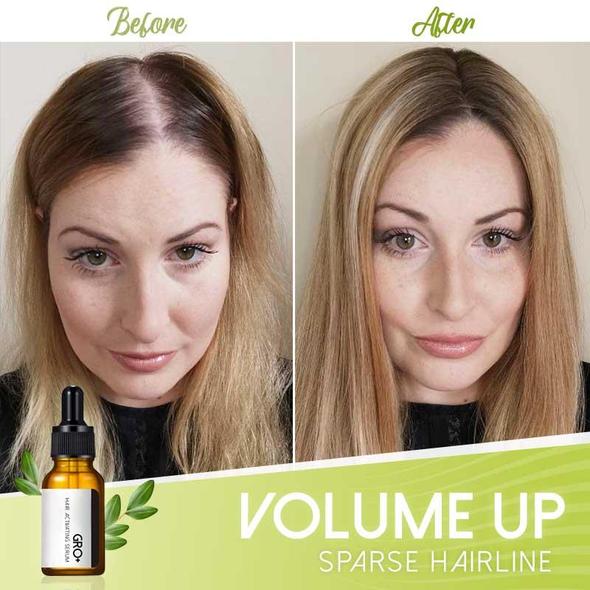 Gro+ hiuksia aktivoiva seerumi - Image 4