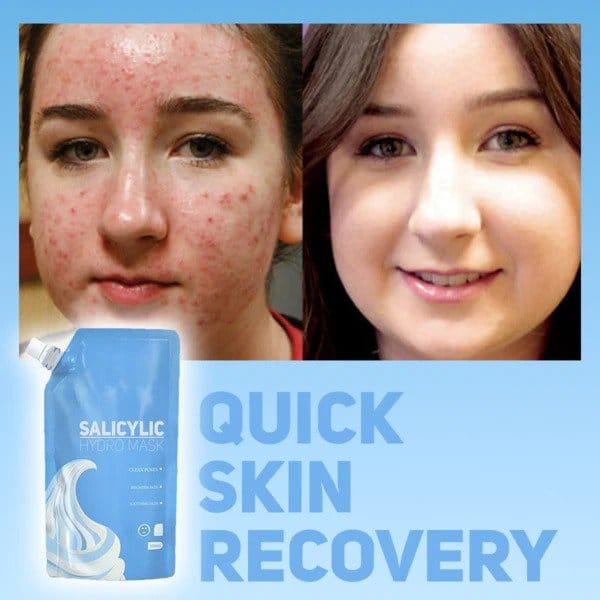 Salisyylihydro naamio - Image 4