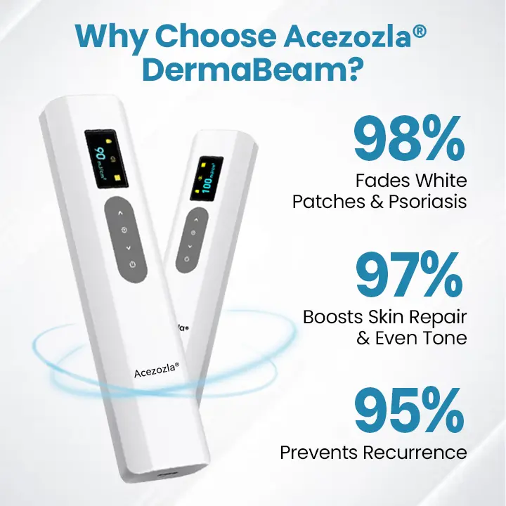 Acezozla® DermaBeam Vitiligo-hoitolaite - Image 6