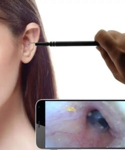 Endoskooppikorvahakukamera