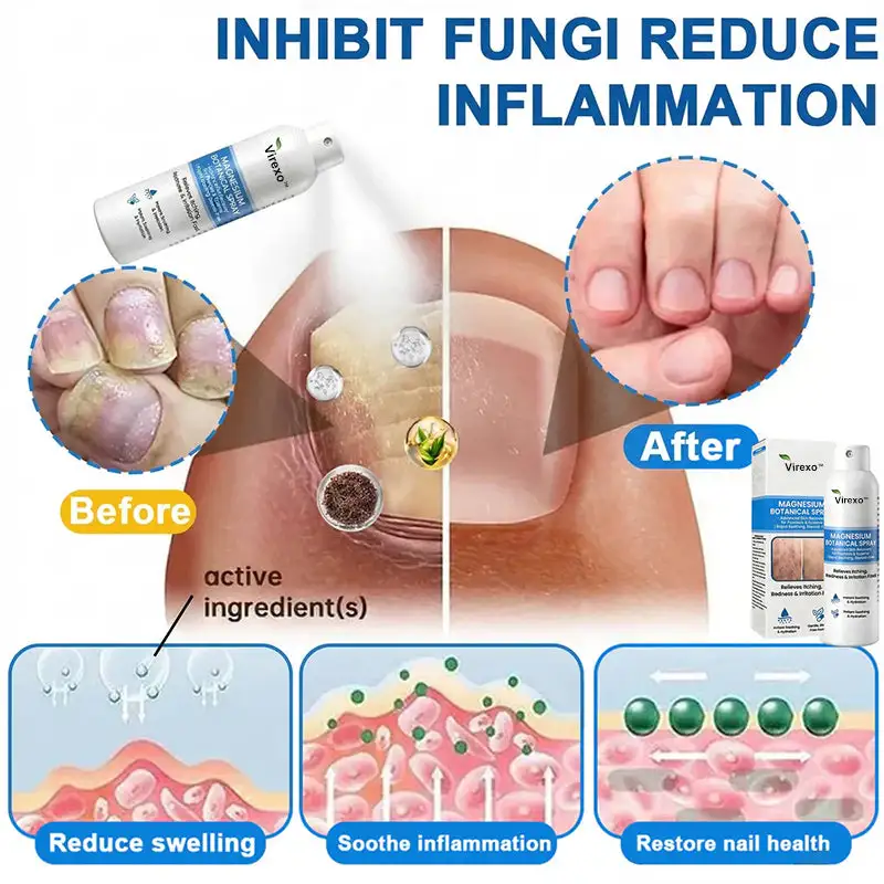 Virexo™ Magnesium Botanical Spray - Image 4