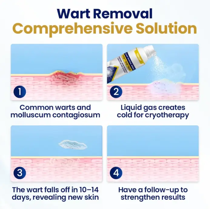 Yagoo® Chillique Bump Renewal Spray - Image 3