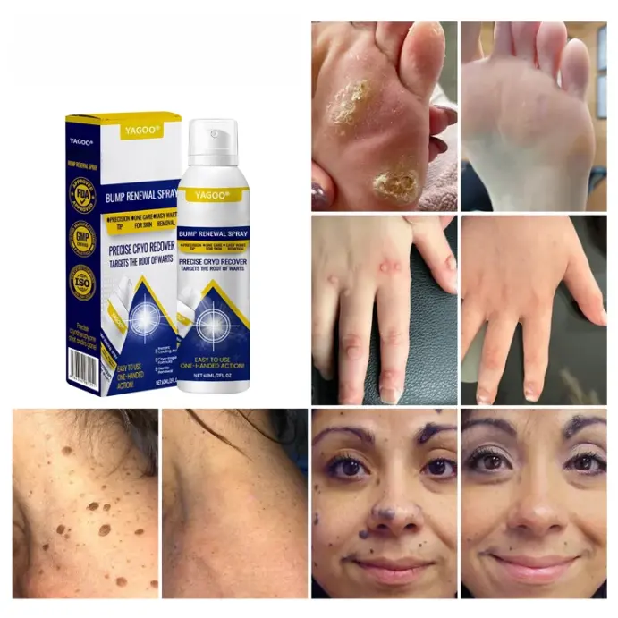 Yagoo® Chillique Bump Renewal Spray - Image 5